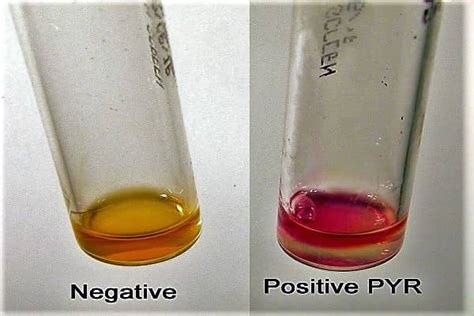 biochemical test for streptococcus pyogenes